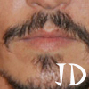 Avatars Monden lippen 