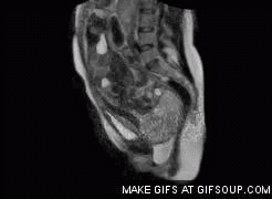 Baby GIF. Baby Gifs Mri Zijnde Geboren 
