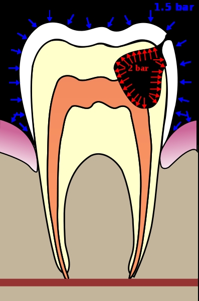 Plaatjes Gebit 